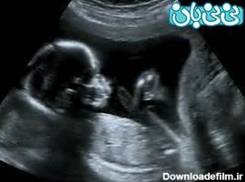 حرکات جنین در رحم، از سه ماهه اول تا سوم (3)