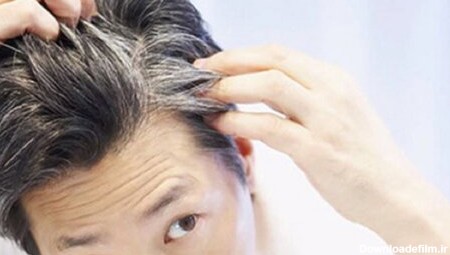 ۷ علت سفید شدن مو در جوانی و راهکار درمان آن - همشهری آنلاین