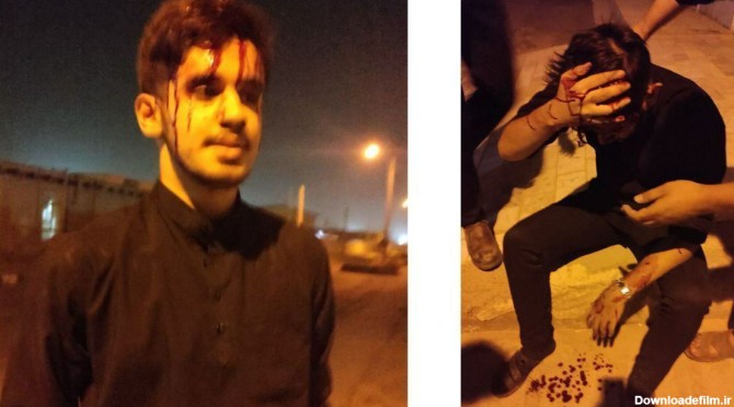 حمله خونین به مداح و 2 جوان هیرمندی در شب چهارم محرم + عکس
