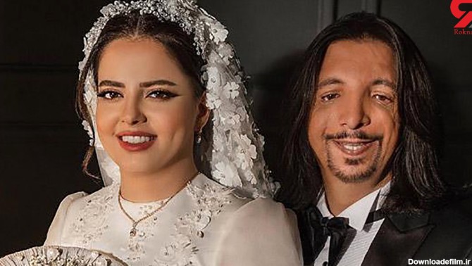 این عروس ایرانی جهان را تکان داد ! / ازدواج با داماد عجیب چهره ! + ...