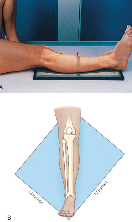 تکنیک های رادیوگرافی ساق پا