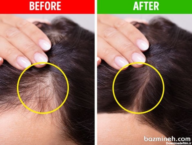 9 روش شگفت انگیز که موهای نازک را ضخیم تر می کند | بزمینه