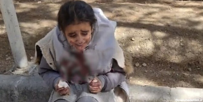 ماجرای دختر دانش‌آموز اصفهانی با صورت خون‌آلود چه بود؟