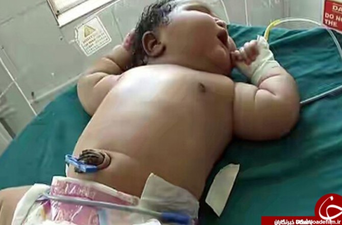 سنگین وزن‌ترین نوزاد جهان به دنیا آمد +تصاویر