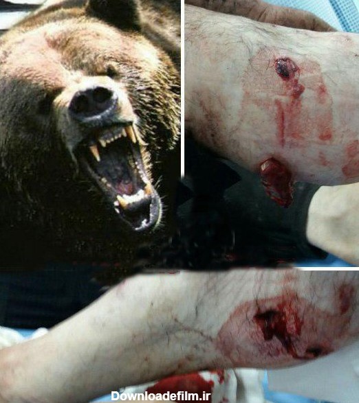 فرارو | (عکس) حمله خرس به پیرمرد قزوینی