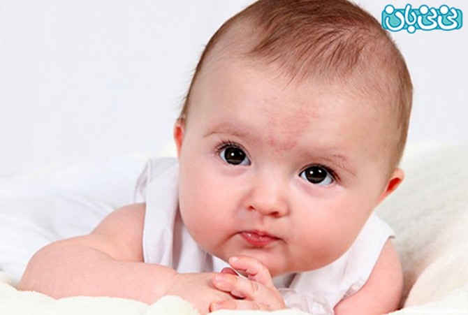 خال مادرزادی در نوزادان، کدامها خطرناکند؟
