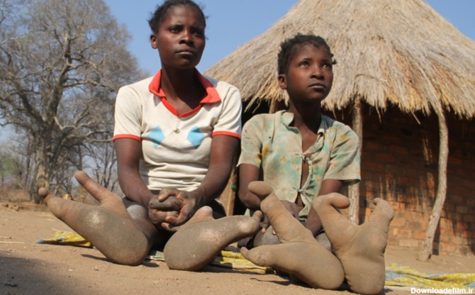 یک قبیله آفریقایی با پاهای عجیب و غریب اما واقعی! (+عکس)