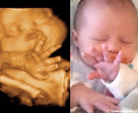 شباهت جالب کودکان قبل و بعد از تولد