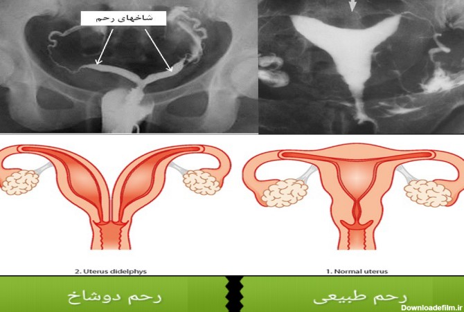 مراکز عکس رنگی رحم در یزد