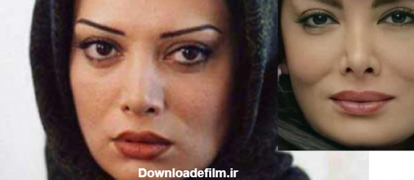دختر چشم درشت کدام خانم بازیگر جذاب است ! + عکس قبل و بعد عمل زیبایی !