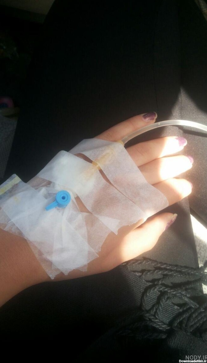 عکس دست سرم زده دختر در بیمارستان - عکس نودی