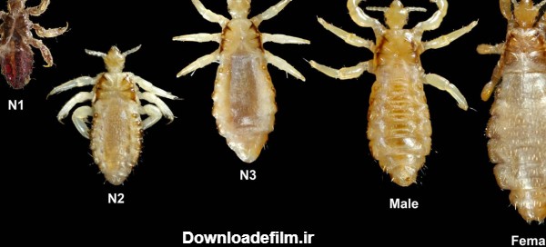 عکس شپش از نمای نزدیک