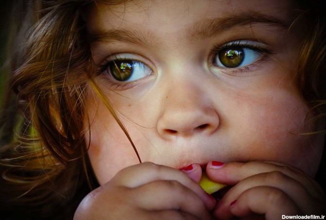 نشانه های خاموش تنبلی چشم در کودکان | دکتر کرمانی