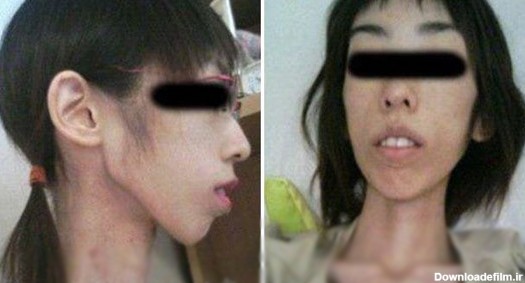 شکنجه عجیب دختر جوان ژاپنی با کاهش وزن +عکس
