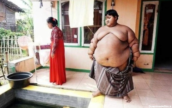 چاق‌ترین پسر جهان لاغر شد/تصاویر
