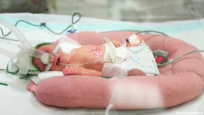 زندگی نوزادان زودرس پس از تولد در هفته‌های مختلف بارداری