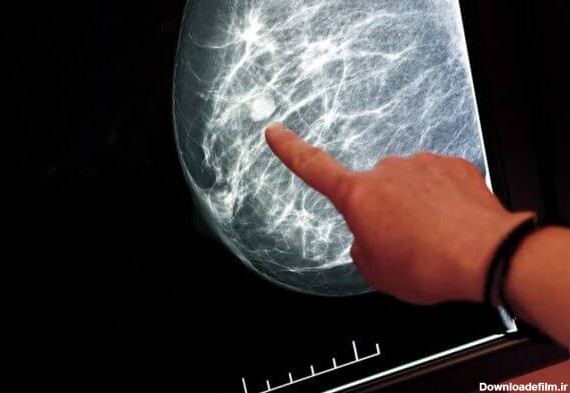 ماموگرافی چیست و آیا همان سونوگرافی سینه است؟ | مجله سلامت حال
