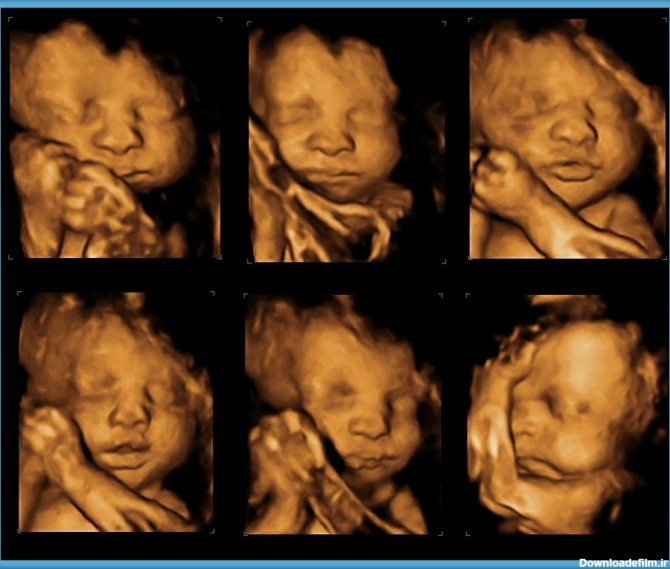 عکس جنین در هفته سی ام بارداری تصویر و اندازه جنین | نی نی پلاس