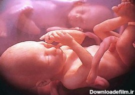 عکس های جالب از جنین های چند قلو - تابناک | TABNAK