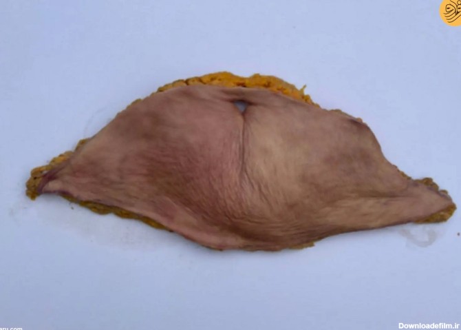 فرارو | (تصاویر) یک زن پوست شکم خود را به چرم انسانی تبدیل کرد!