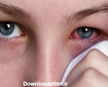 انواع آسیب چشمی یا ترومای چشمی و راه‌های درمان آن | پذیرش۲۴