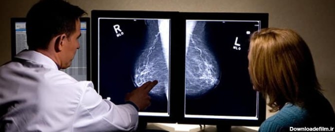 سرطان سینه، تنها دلیل وجود یک توده در سینه نیست. ماموگرافی می‌تواند نشان دهد دچار فیبروز یا کیست نیز شدید.