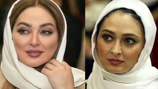 چهره بازیگران زن ایرانی قبل و بعد عمل زیبایی/ عکس