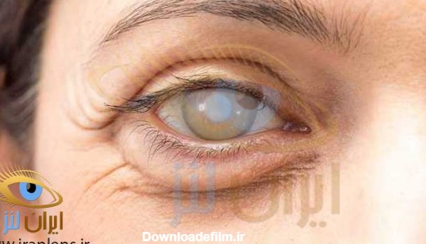 علائم و روش های جلوگیری از ضعیف شدن چشم ها چیست؟ | فروشگاه ایران لنز