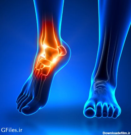 عکس با کیفیت درد مچ پا (Ankle pain)