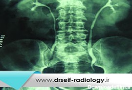 رادیولوژی از مجاری ادراری (IVP)