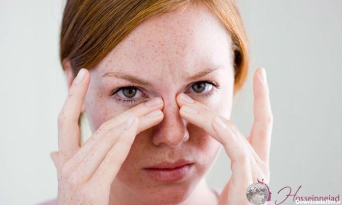 عوامل موثر در میزان تورم و کبودی پس از جراحی بینی