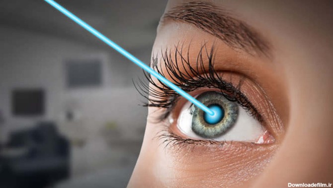 انواع عمل چشم | آشنایی با انواع عمل چشم برای رفع عیوب و زیبایی چشم