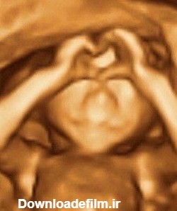 ژست عجیب جنین درون شکم مادرش + عکس - چشم برخوار