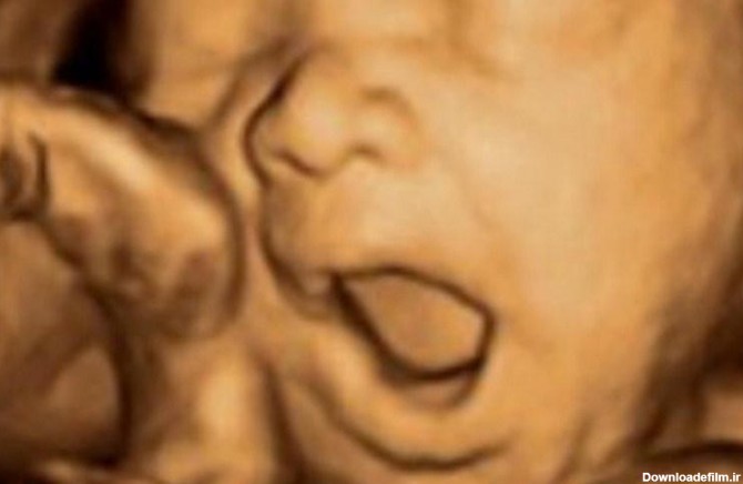سونوگرافی جنین در هفته 23 بارداری