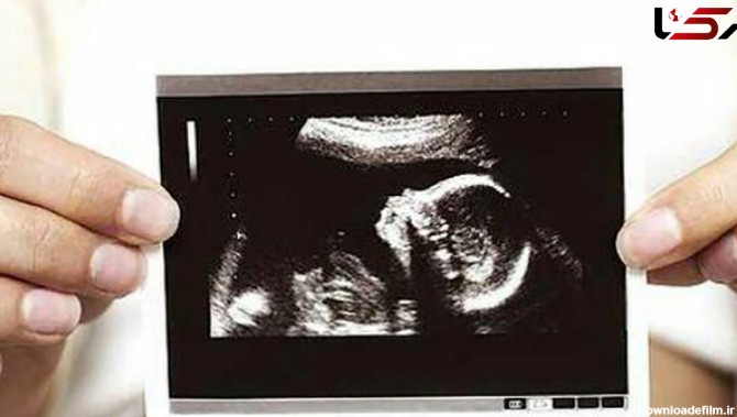 عکس عجیب جنین ، موجب وحشت زن جوان باردار شد + تصاویر