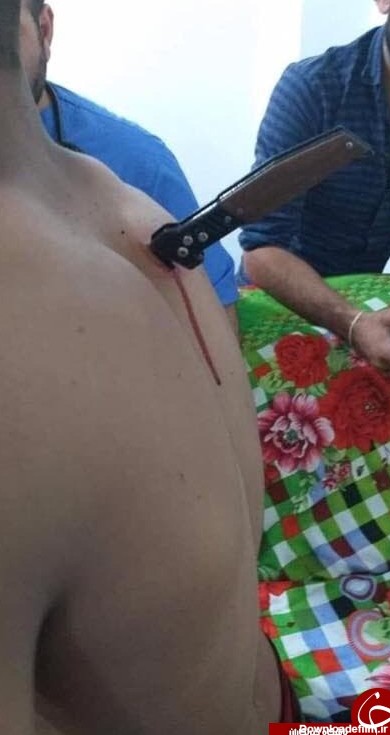 حمله خونین زن داعشی با چاقو به یک سرباز + تصاویر