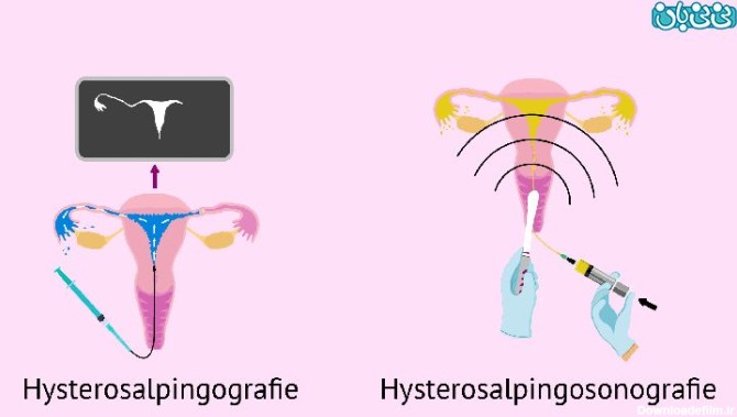 هزینه عکس رنگی از رحم در تبریز