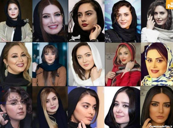 بازیگران ایرانی سردمداران عمل زیبایی در جهان / لو رفتن عکس ...