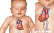 درمان جدید بیماری‌های قلبی مادرزادی | خبرگزاری فارس