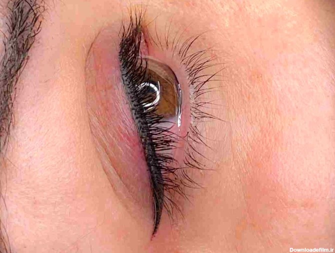 درمان سریع التهاب چشم بعد از تاتو خط چشم