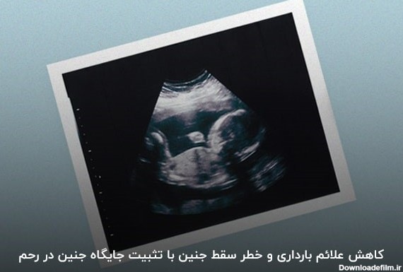 مراقبت های سه ماهه اول بارداری - آدوراطب