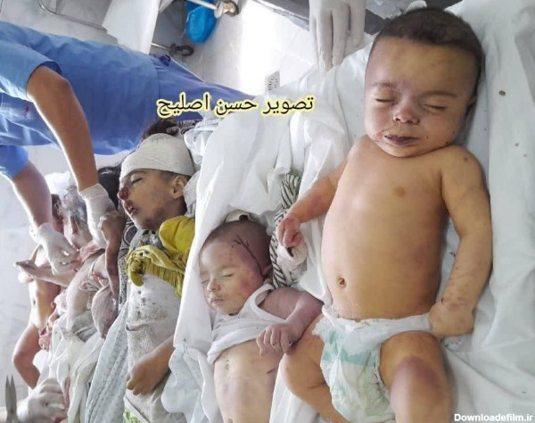 عکس/ قتل عام کودکان در بمباران مناطق مسکونی توسط رژیم صهیونیستی