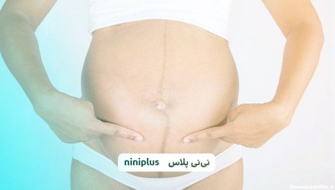 خط قهوه ای روی شکم در بارداری (لینا نیگرا) چیست؟ | نی نی پلاس