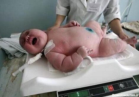 این نوزاد مشهدی سنگین وزن ترین نوزاد متولد شده جهان است؟/ عکس