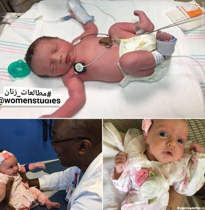 نوزاد دختری که در آمریکا دوبار به دنیا آمد! +عکس - مشرق نیوز