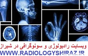 مقالات رادیولوژی | مراکز رادیولوژی و سونوگرافی شیراز
