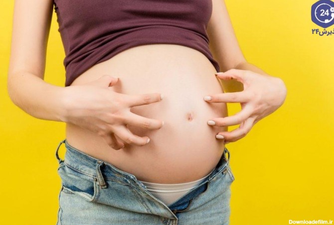 همه آن چیزی که باید درباره علل خارش بدن در بارداری و راه‌های درمان ...