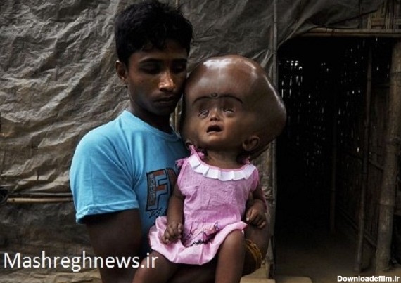 وحشتناک‌ترین کودک جهان+عکس | خبرگزاری فارس