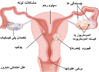 عکس رنگی از رحم سالم