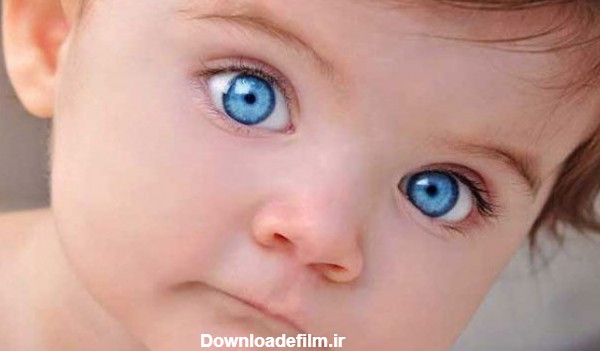 همه روش های تشخیص و درمان انحراف چشم نوزاد - ۳۰ سیب سایت جامع ...